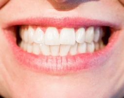 teeth cleaned by Corona Del Mar CA dental hygienist